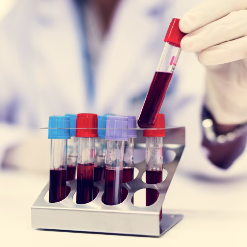 Fertility Lab Testing in Boise, Idaho